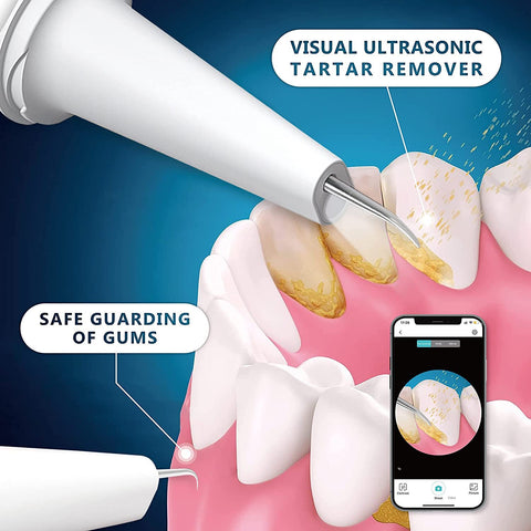 Intelligent Visual Ultrasonic Tooth Scaler Removal And Beauty Instrument