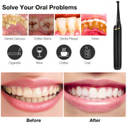 Household electric dental scaler