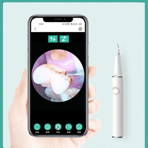 Household Electric Dental Scaler Visually Mini Portable